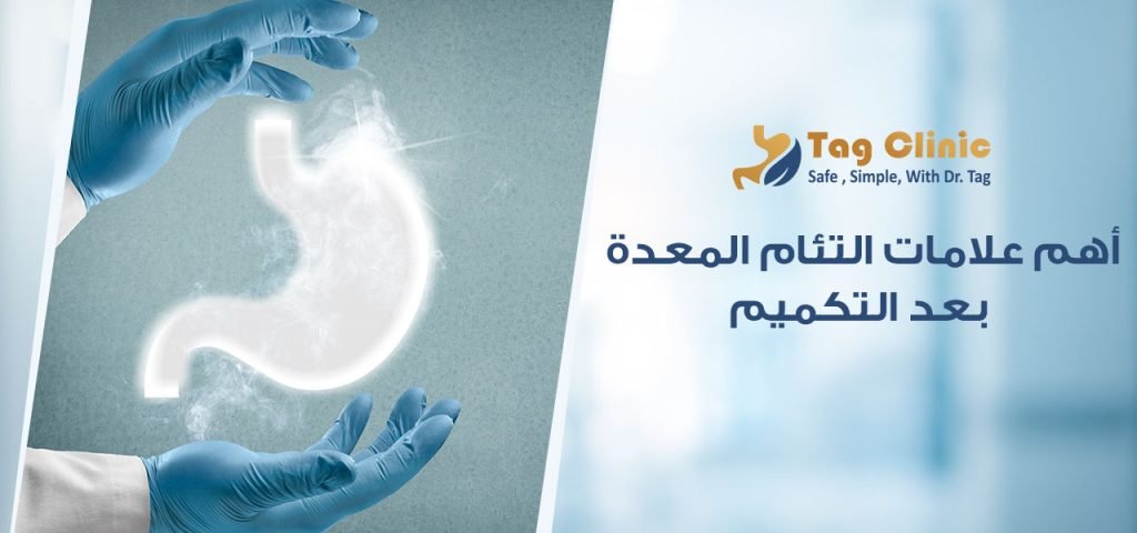 علامات التئام المعدة بعد التكميم